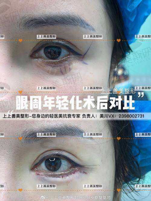 庆阳整形医院排名第一会是哪家?