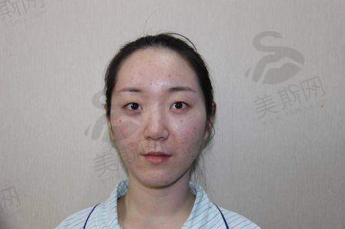 西安西 京医院整形美容科开展项目及适合人群