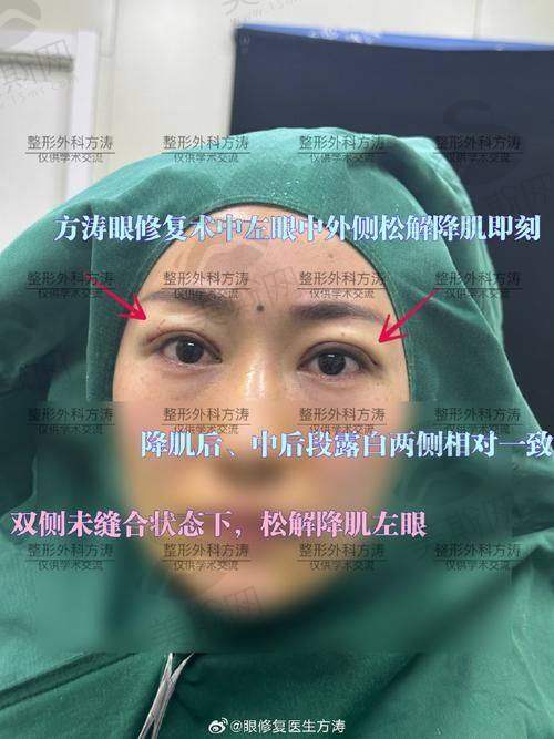 西 京医院眼部整形项目真相