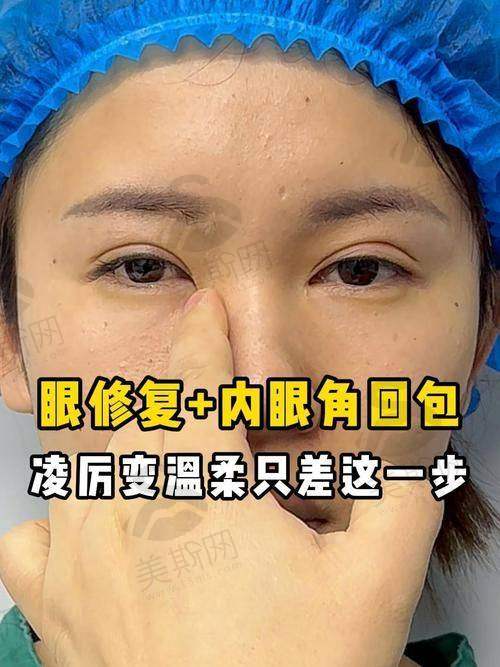选择成都整形美容医院的避坑要点
