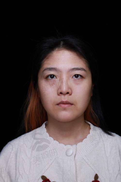 昆明韩辰整形医院口碑怎么样