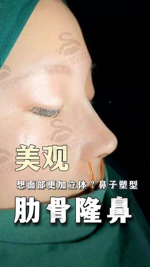 西安出名整形医院术前术后避坑指南