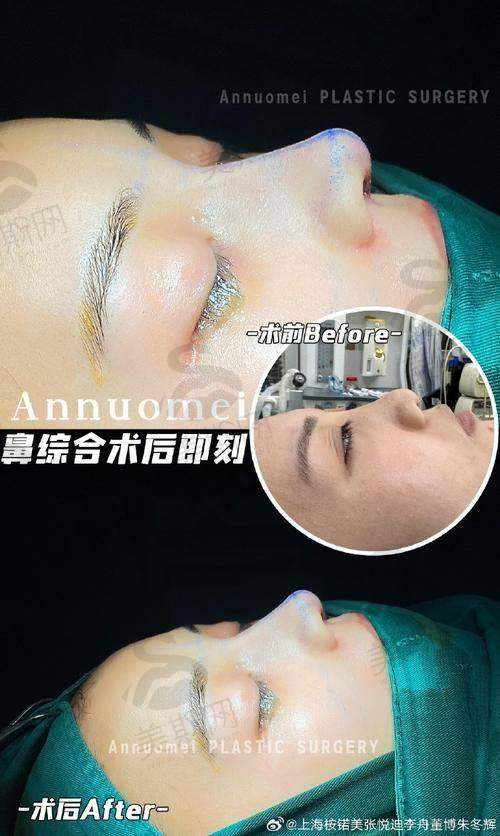 西 京医院轻医美项目真相