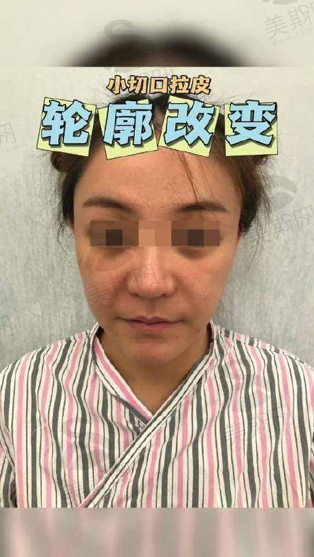 术前术后避坑指南