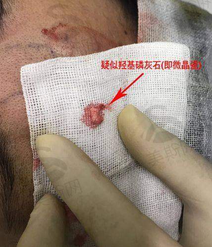 总结