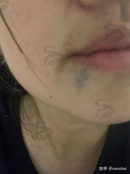 成都艺星整形医院的热门项目及价格