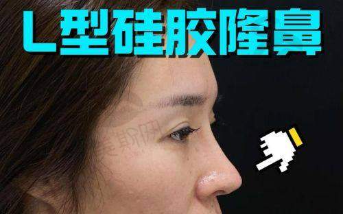 总结