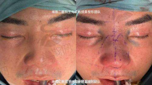 惠州伊丽莎白整形美容——综合实力的强者