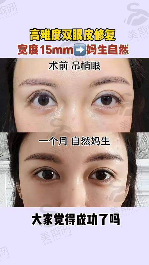 重 医附一院整形美容科医生团队怎么样