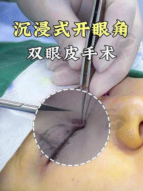 吕方中医生技术如何
