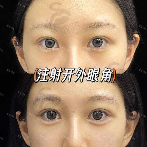 吕方中医生的手术口碑怎么样