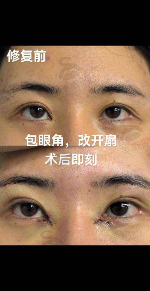 如何选择适合自己的长春美容整形骨干医生