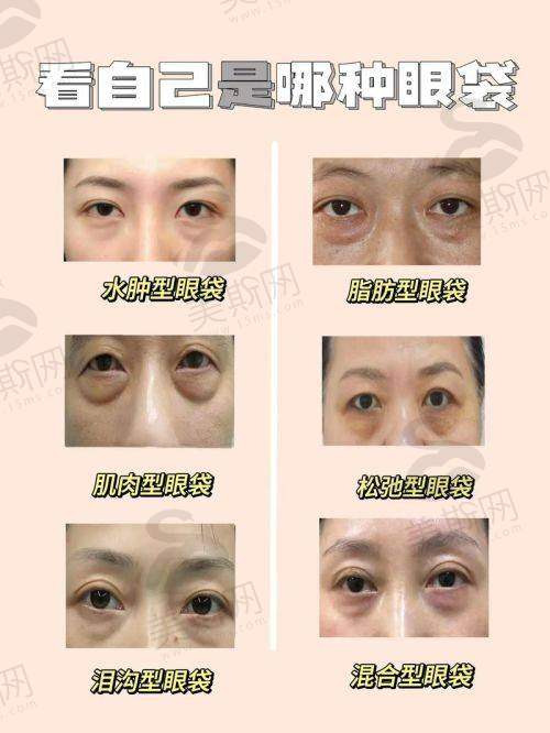 绵阳其他整形医院的特点与选择建议