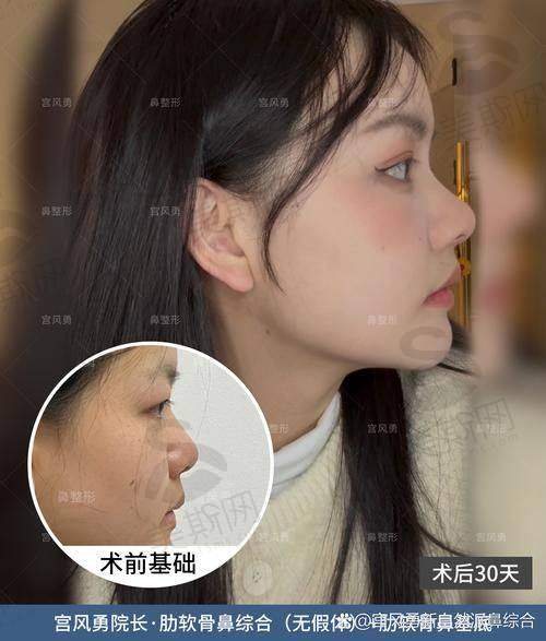 术前术后避坑指南
