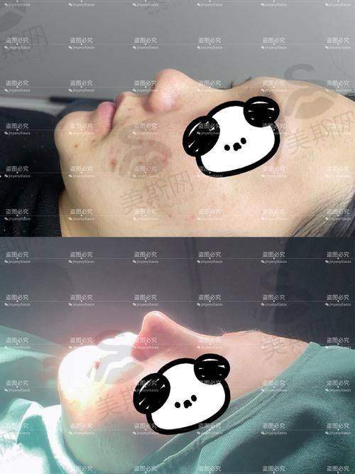 总结
