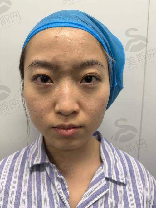 术前术后避坑指南