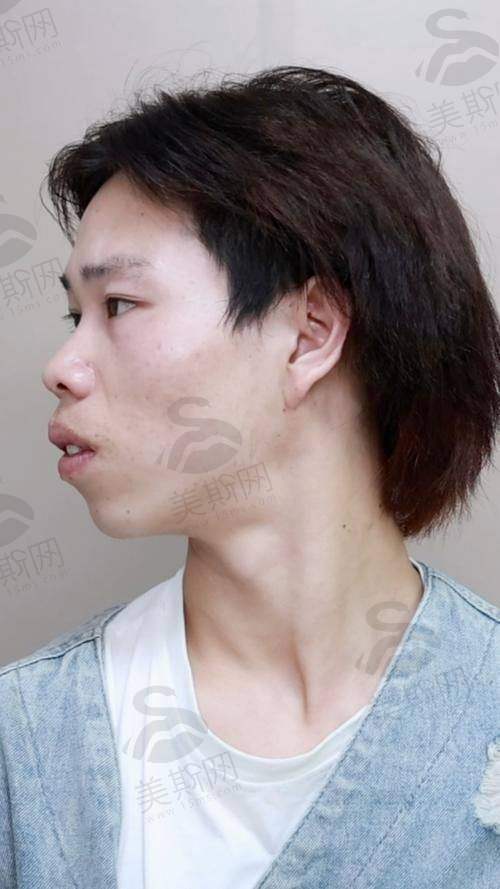 广州广大医院——正颌领域佼佼者
