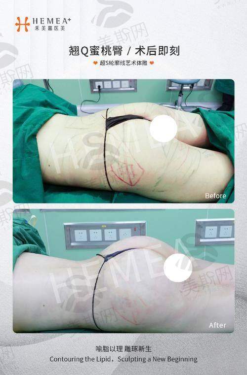 重庆西 南医院整形科怎么样
