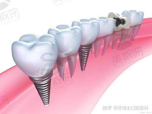 张家界十大口腔医院排名榜新鲜出炉！张家界口腔医院、张家界大众口腔等位列其中！ 