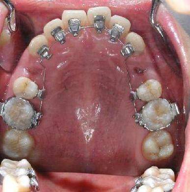 总结