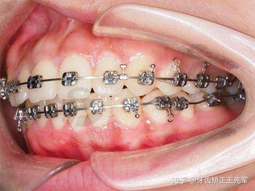 张家界十大口腔医院排名榜技术优势