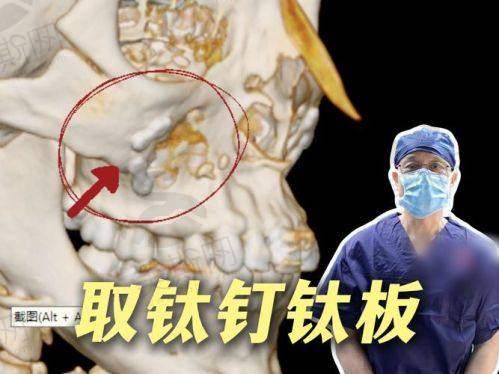 总结