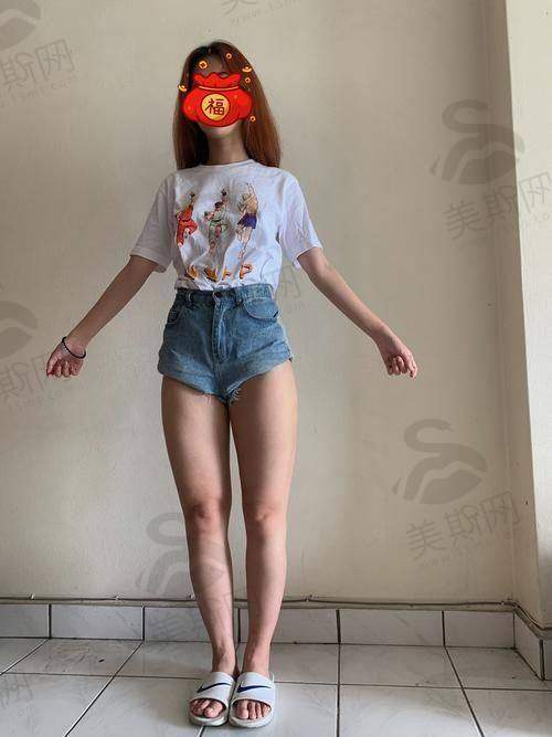 重 医附一院整形美容科挂号方式有哪些