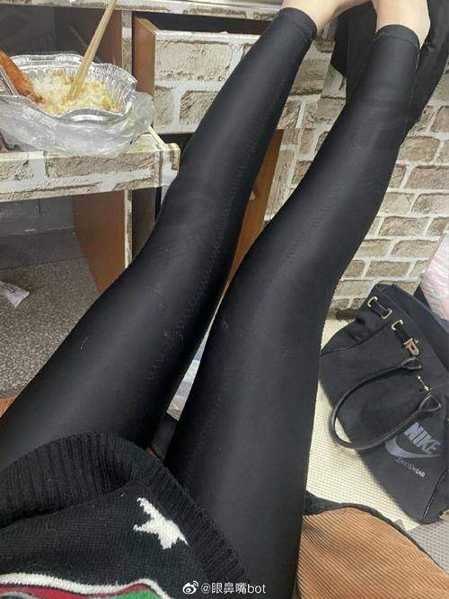 广州曙光疤痕胎记医院的技术靠谱吗