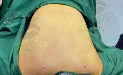 如何选择适合自己的拉萨美容医院