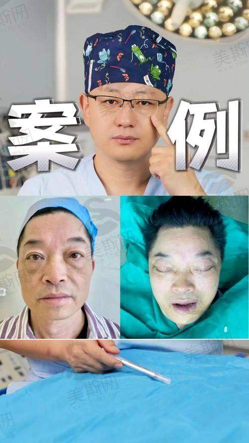 武汉徐国建无痕筋膜提升地址在哪