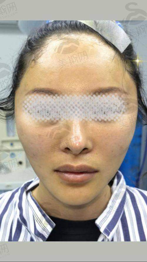 沈阳能做微拉美医院的价格表