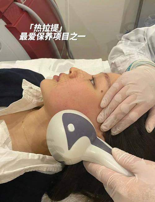 北京面部筋膜提升价格情况