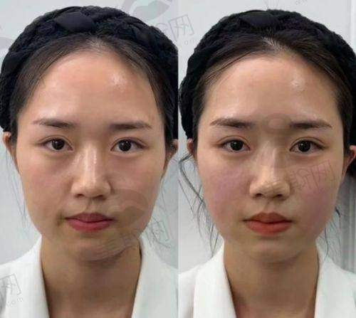 在广州曙光医院做项目的术前术后避坑指南