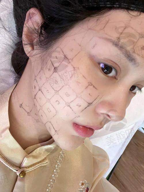 术前术后避坑指南