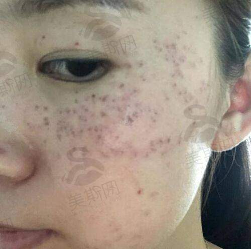 酒泉华美医疗美容医院地址及预约方式