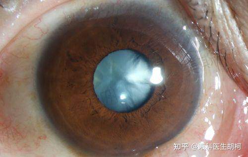 北京同仁眼科骨干医生云波:白内障手术的“高产好评王”