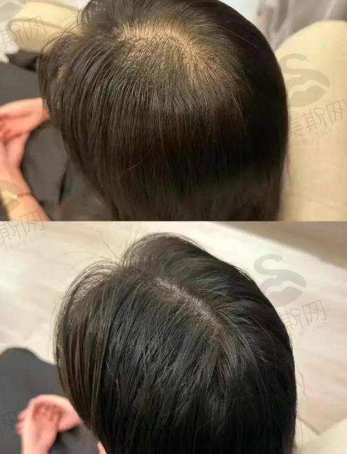 江门植发医院怎么样