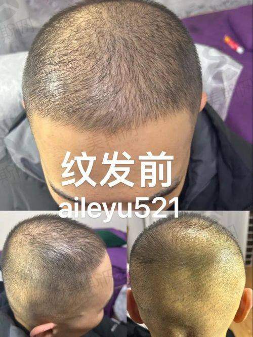 北京协和医院植发科室医生介绍