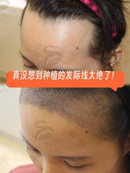 福州微创植发医院地址大公开