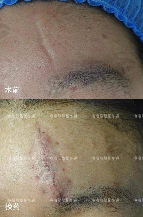 江门植发医院哪家更好