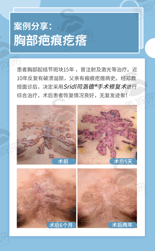 广州曙光植发医院的技术靠谱吗