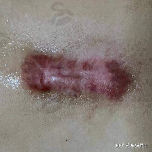 总结