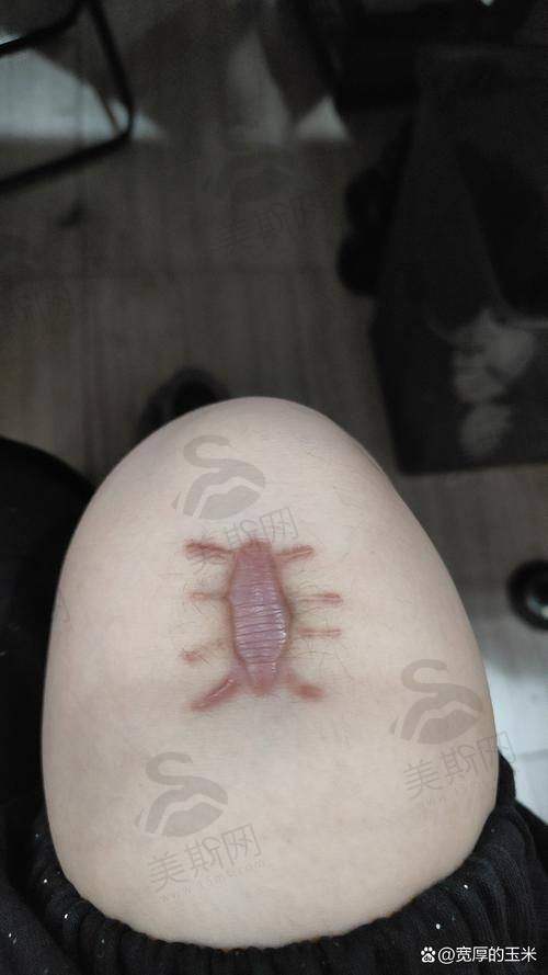 术前术后避坑指南