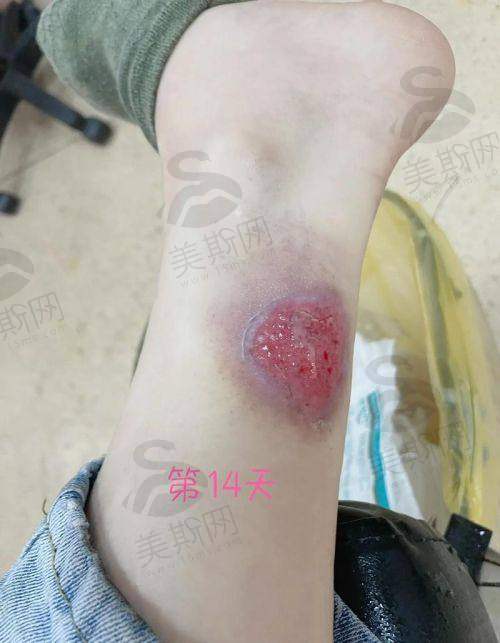 总结