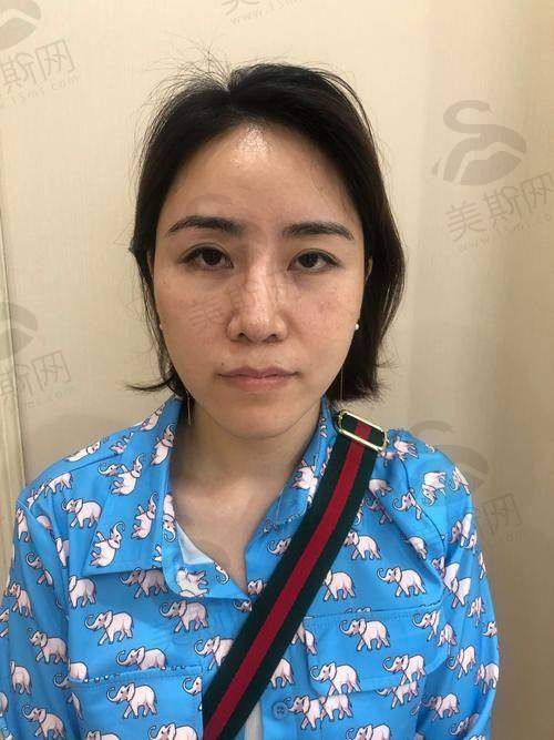 南京美容整形医院术前术后避坑指南