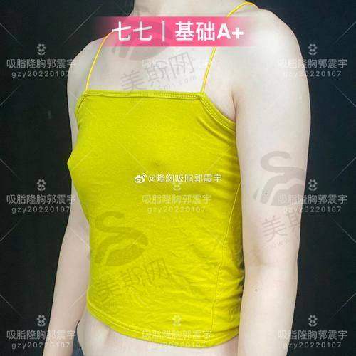 总结