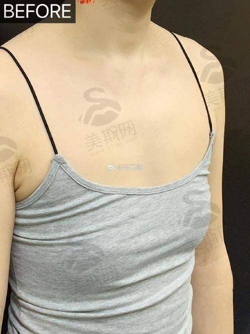 总结