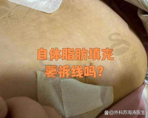 理性提醒