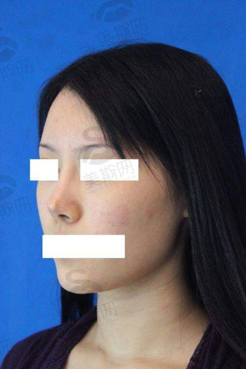 温州整形三甲公立医院排名揭秘！温州医科大学附属第一医院、温州市中心医院实力上榜！ 