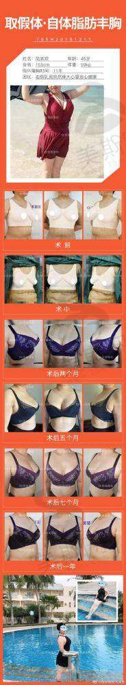 总结